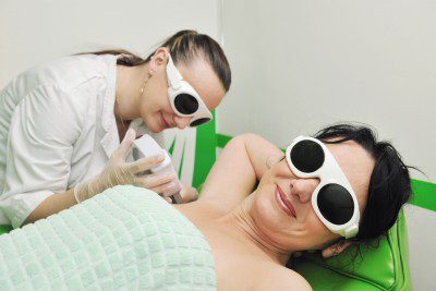 laser hair removal 