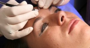Hair Removal | Electrology | Permanent Hair Removal