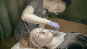 Microneedling