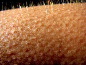 Does Laser Hair Removal Work On Blonde Hair