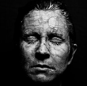 woman, dry skin, face