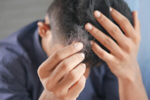 a man is combing his hair with his hands | Hair Loss