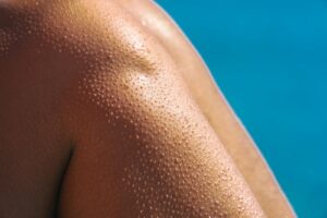 Detailed shot of goosebumps on a tanned shoulder next to a pool, perfect for summer concepts.
