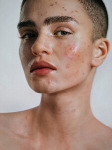 Ai generated portrait of model with bare shoulders | oily skin in humid weather